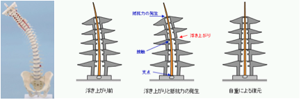 spinal cord pagoda